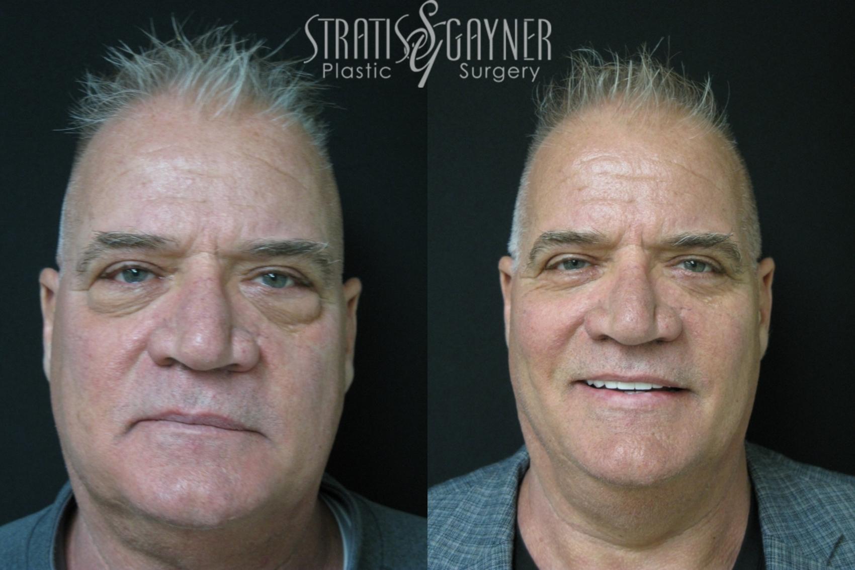 Stratis Gayner Plastic Surgery
